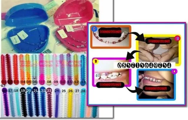 Els adolescents asiàtics es posen brackets falsos per anar a la ... Els adolescents asiàtics es posen brackets falsos per anar a la ...