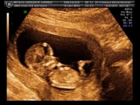 EMBARAZO 12 SEMANAS ECOGRAFÍA 3D - ULTRASOUND 3D 12 WEEKS - YouTube EMBARAZO 12 SEMANAS ECOGRAFÍA 3D - ULTRASOUND 3D 12 WEEKS - YouTube