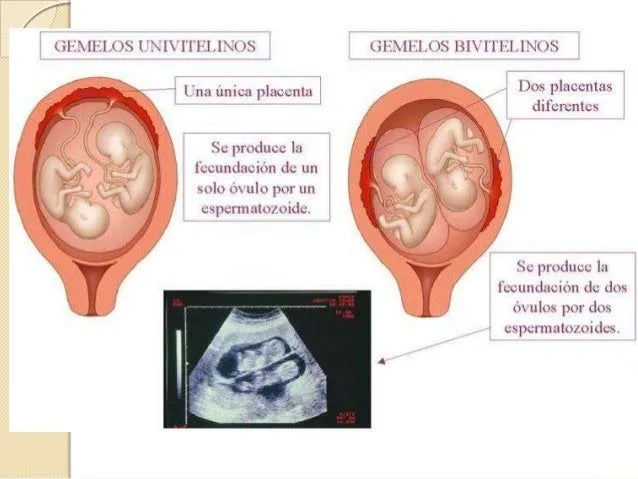 embarazo-gemelar-3-638.jpg?cb= ...