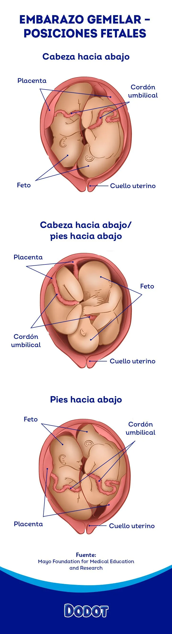 Embarazo de gemelos semana a semana | Dodot Embarazo de gemelos semana a semana | Dodot