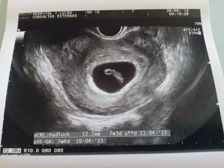 Embarazo de 7 semanas: pancitas y ultrasonidos | Blog Embarazo de 7 semanas: pancitas y ultrasonidos | Blog