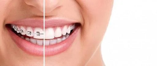 Endodoncias, ortodoncia, periodoncia, implantes, brackets ... Endodoncias, ortodoncia, periodoncia, implantes, brackets ...