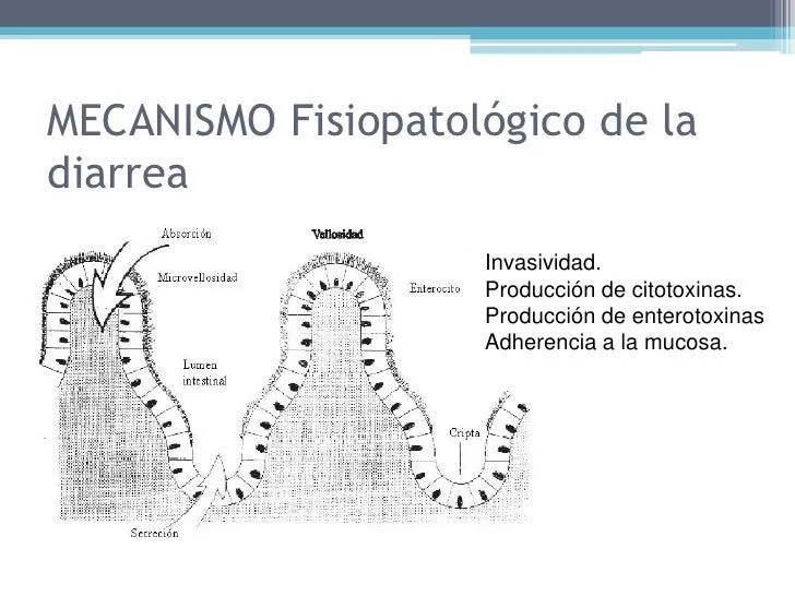 enfermedad-diarreica-aguda-13- ...