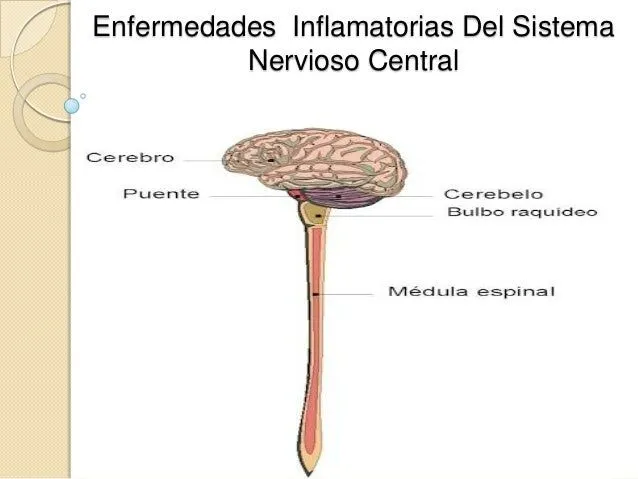 Enfermedades inflamatorias del sistema nervioso central Enfermedades inflamatorias del sistema nervioso central