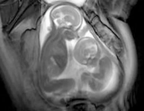 Enfoque Radiologico: diciembre 2012