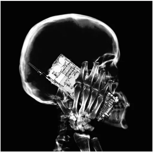 ESQUELETO DE LA RADIOGRAFÍA EN NEGRO Y BLANCO DEL ESCULTURA ... ESQUELETO DE LA RADIOGRAFÍA EN NEGRO Y BLANCO DEL ESCULTURA ...