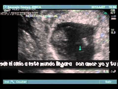 AQUI ESTOY...(cancion para un bb que viene en camino) - YouTube AQUI ESTOY...(cancion para un bb que viene en camino) - YouTube