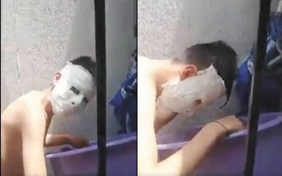 Estudiante crea máscara de yeso y se le queda pegada, dice que demandará a su maestra - El Sol de Tampico | Noticias Locales, Policiacas, sobre México, Tamaulipas y el Mundo Estudiante crea máscara de yeso y se le queda pegada, dice que demandará a su maestra - El Sol de Tampico | Noticias Locales, Policiacas, sobre México, Tamaulipas y el Mundo