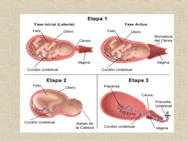 Etapas del parto!!!