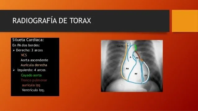 evaluacin-cardiaca-por- ...