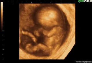 Fecundación, embarazo y parto: Fecundación, Embarazo y Parto