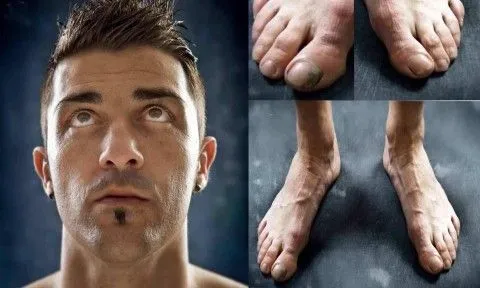 Así de FEOS son los pies de los futbolistas #eslamoda Así de FEOS son los pies de los futbolistas #eslamoda