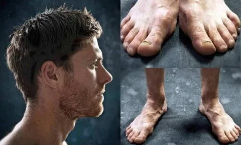 Así de FEOS son los pies de los futbolistas #eslamoda