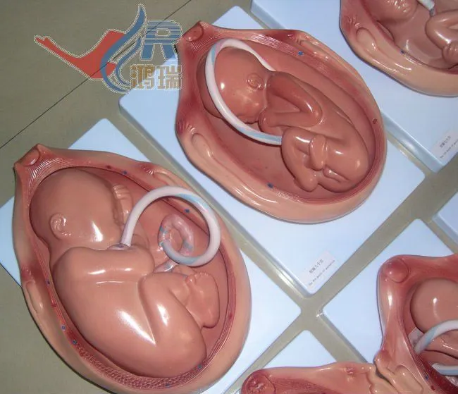 Feto 5 meses embarazo - Imagui