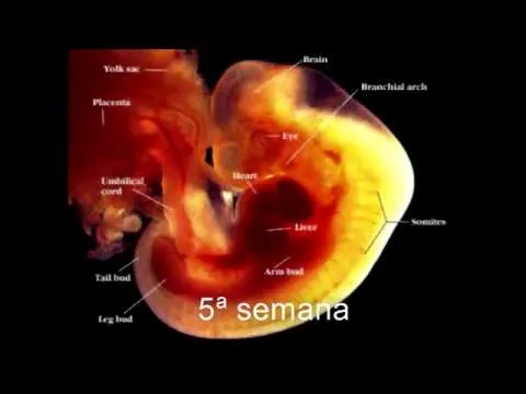 FETO - YouTube
