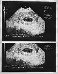 Son fiables los tests de embarazo? | Me crecen los enanos