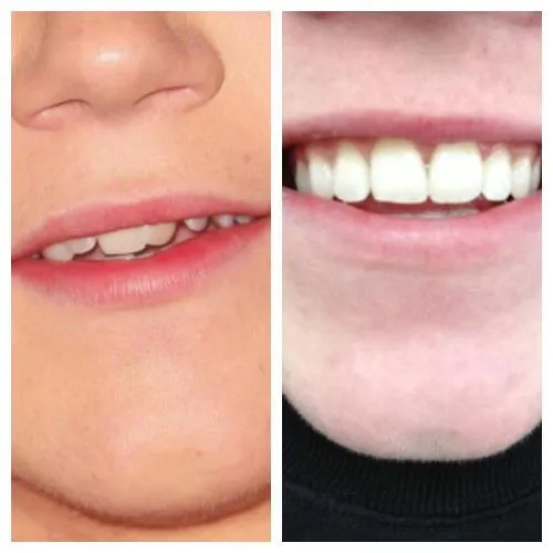 Forever Directioner: Niall sin brackets.