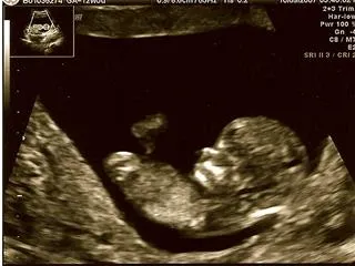 esta es la barriga de mi mami con 16 semanas. esta es la barriga de mi mami con 16 semanas.