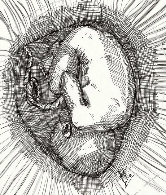 Feto" | Dibujos y más dibujos extraños