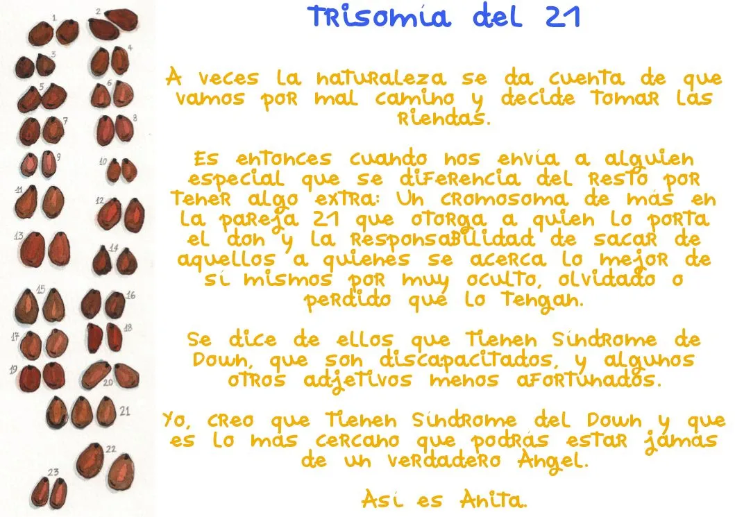 El sueño de la tortuga azul | DOWNberri