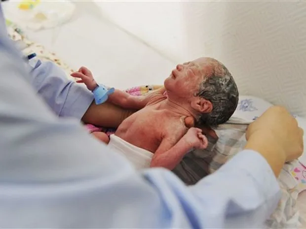 Bebés con 34 semanas - Imagui
