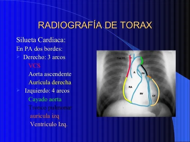 generalidades-de-la-radiologa- ...