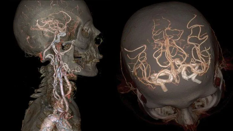 HD: el cuerpo humano por dentro, como nunca antes se vio | Fotos ... HD: el cuerpo humano por dentro, como nunca antes se vio | Fotos ...