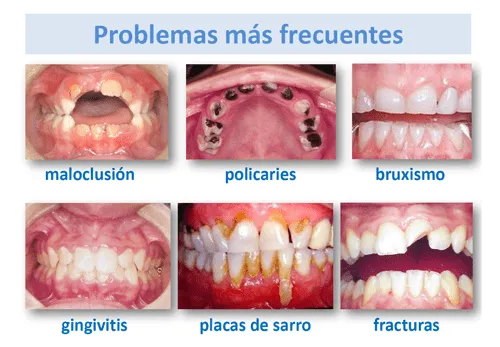 Higiene bucal en las enfermedades metabólicas | Guía metabólica