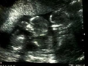 Una historia de victoria sobre el aborto … porque con Dios siempre ... Una historia de victoria sobre el aborto … porque con Dios siempre ...