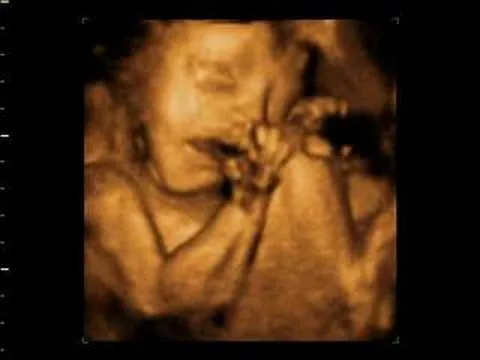 Imágenes de ultrasonidos de 7 meses - Imagui