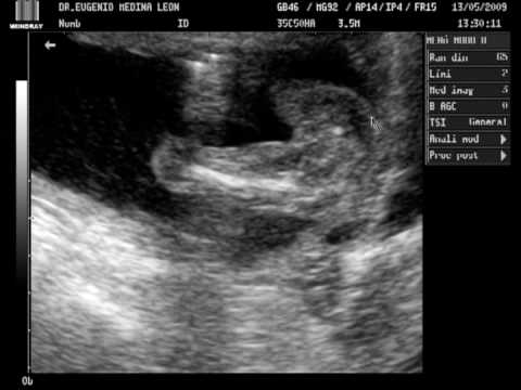 hqdefault.jpg hqdefault.jpg