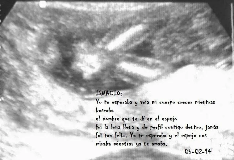 Ignacio, Siempre en el Corazón!!