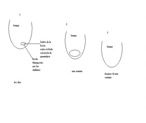 Imagen Dibujo lengua - grupos.emagister.com