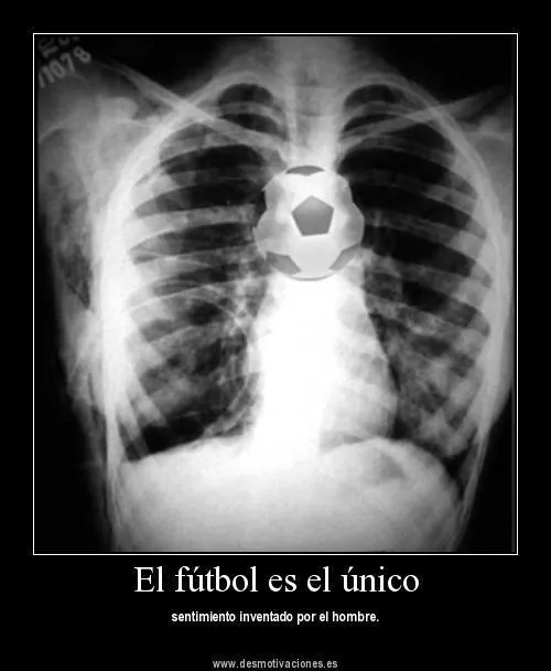 Enamorados Lindas Imagenes De Desmotivaciones De Futbol Para ... Enamorados Lindas Imagenes De Desmotivaciones De Futbol Para ...