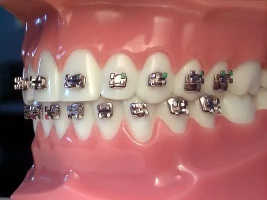 Imagenes de brackets de Hello Kitty - Imagui Imagenes de brackets de Hello Kitty - Imagui