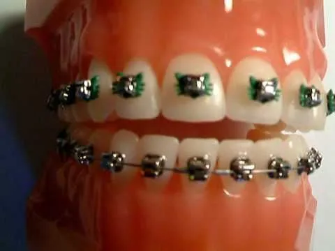 Imagenes de brackets de Hello Kitty - Imagui Imagenes de brackets de Hello Kitty - Imagui