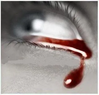 20081117164942-llorando-sangre