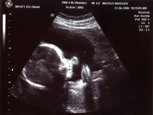 Fotos de ecografias - saludmedica.