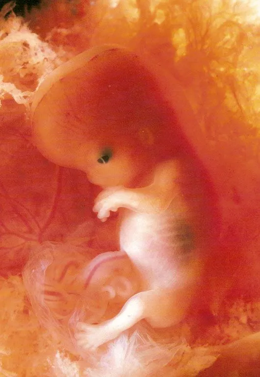 Imágenes edad gestacional | Aborto. La información médica Imágenes edad gestacional | Aborto. La información médica
