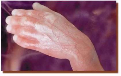 Como es un feto de 2 meses - Imagui