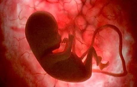 Así es la infantita a los 4 meses de gestación - 20minutos.