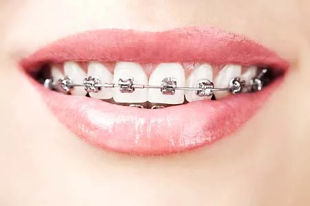 José Ángel Nieto. Clínica Dental. | Ortodoncia