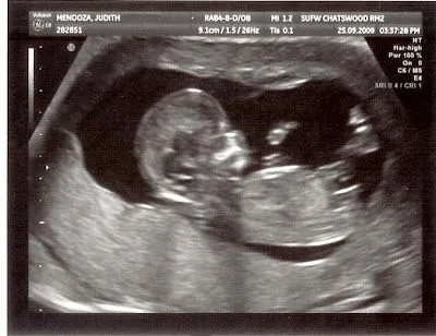 Judith, from Bragado to Sydney...: Repleto de noticias bomba ...