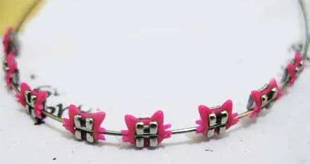 Ligas de brackets con figuras - Imagui