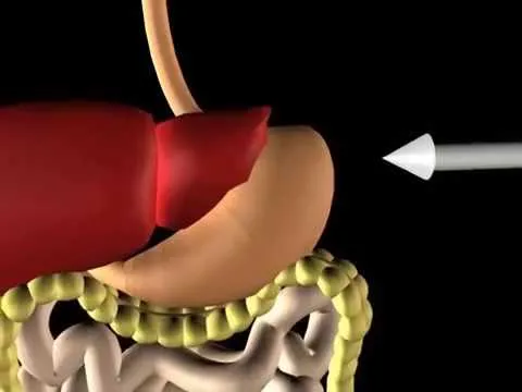Limpieza De Colon Natural y Eficaz