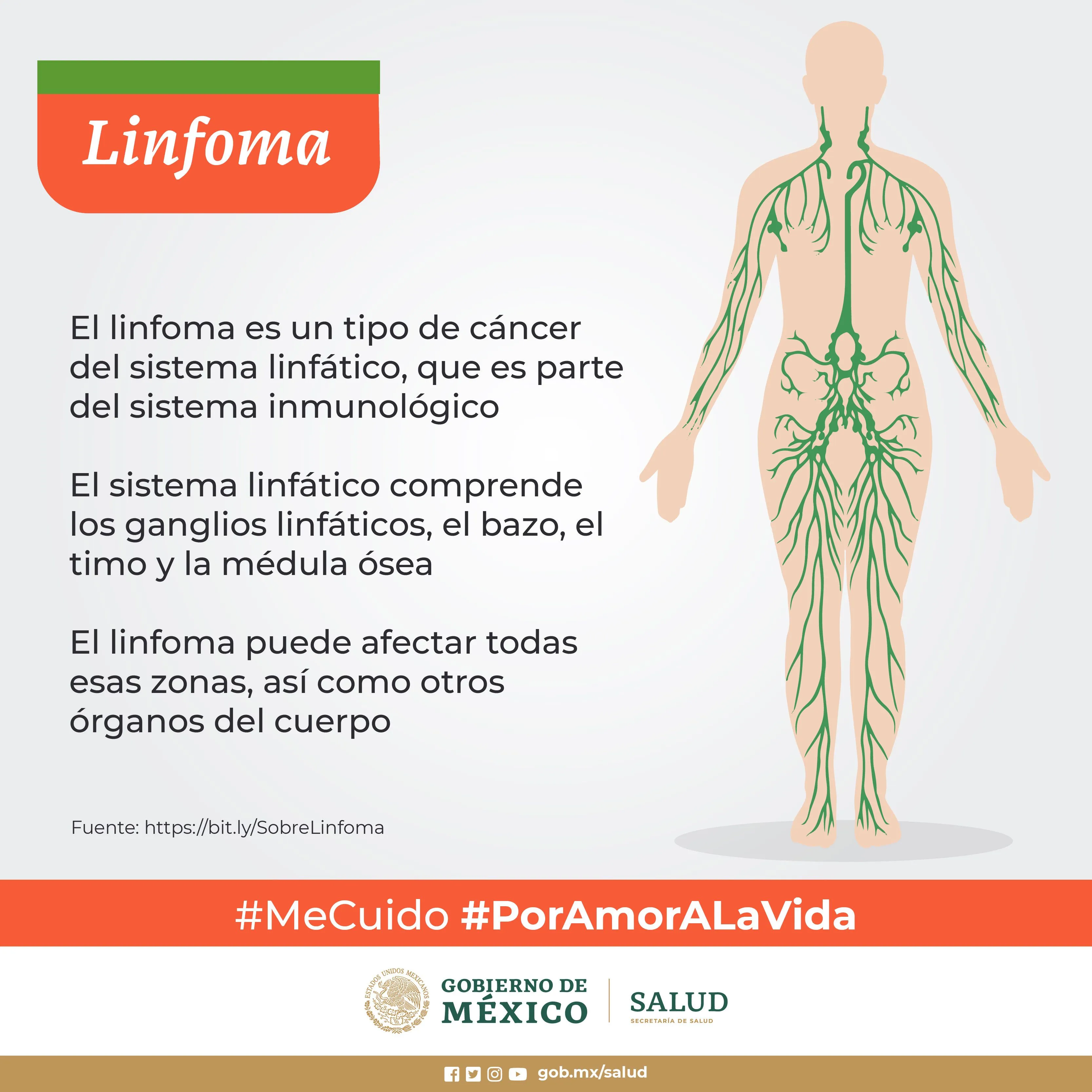Linfoma, enfermedad oncológica que puede ser curable | Secretaría de Salud | Gobierno | gob.mx Linfoma, enfermedad oncológica que puede ser curable | Secretaría de Salud | Gobierno | gob.mx