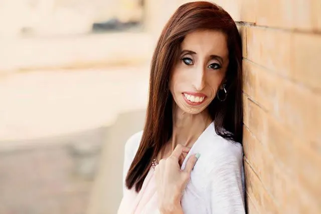 Lizzie Velasquez ¿la mujer más fea del mundo? | Marcianos