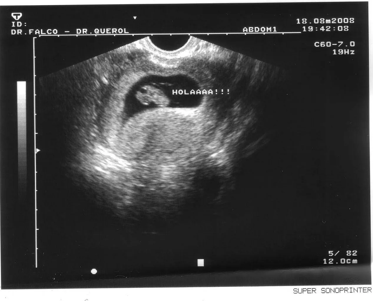 General | Lydiayesteban's Weblog | Página 6 General | Lydiayesteban's Weblog | Página 6