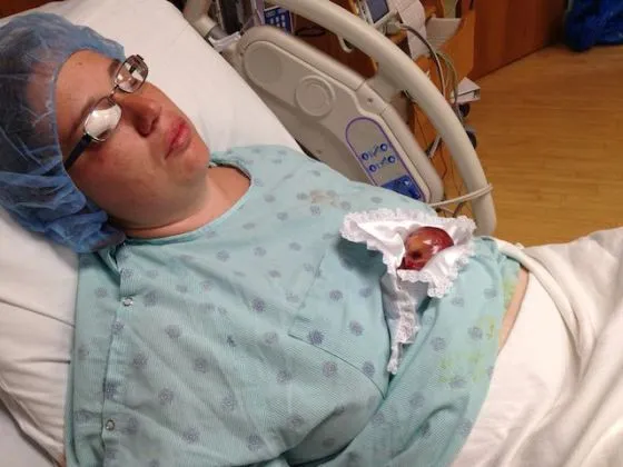 Madre revela impactantes fotos de bebé prematuro de 19 semanas que ...