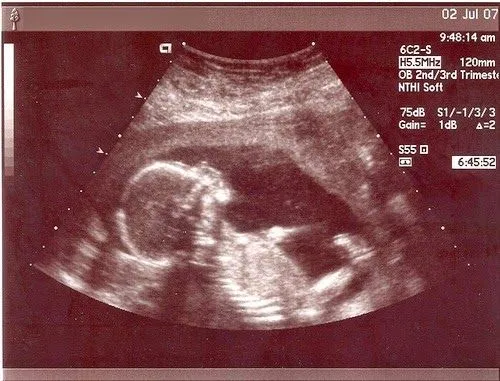 MATERNIDAD Y PSICOLOGÍA ☼: ECOGRAFIAS POR SEMANAS. Imágenes